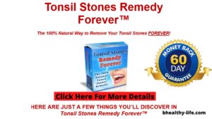 Tonsil Stones Remedy Forever